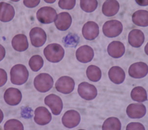 Discovery reveals more about the Birth of Platelets